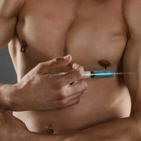What are the side effects of anabolic steroids misuse? 3